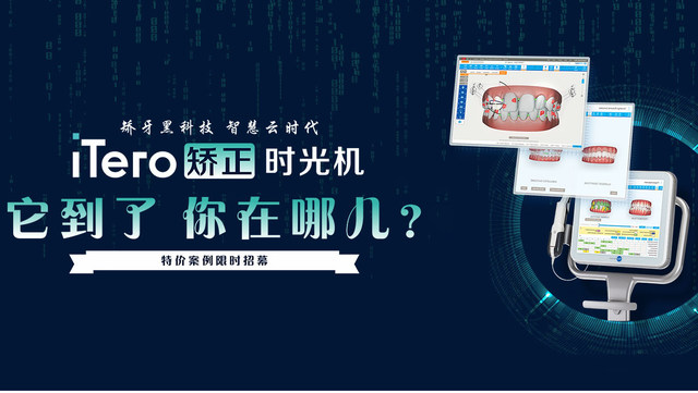 重庆团圆口腔医院矫正牙齿，通过3D数字化影像导航设计，量身定制一系列透明牙托来完成整个矫正过程，避免拔牙，全面把控正畸过程中每个牙齿移动归位。