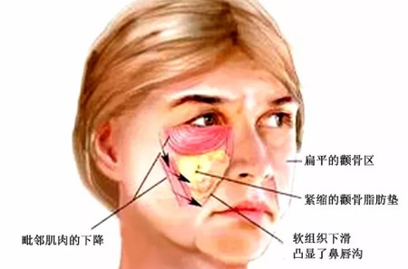 怎样选择面部提升的医疗手段
