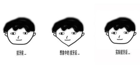 拔智齿能瘦脸吗？