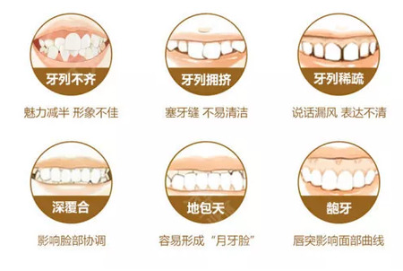 哪些情况需要做牙齿矫正？