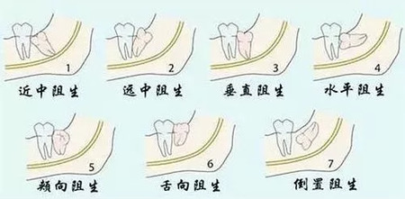 刷牙前牙膏要不要沾水？