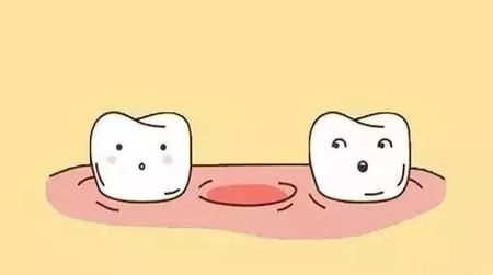 缺牙不补，后果居然这么严重……