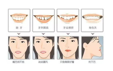 牙齿不齐给带来的伤害也是无法估量的。
