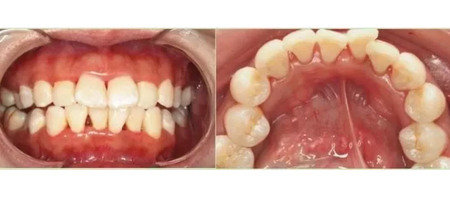 养成良好的口腔习惯很重要