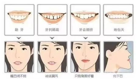 拥有一口整齐漂亮的牙齿有多重要!
