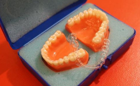 牙齿矫正是用的什么原理？有没有副作用？