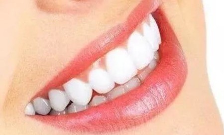 佩戴保持器要注意什么？