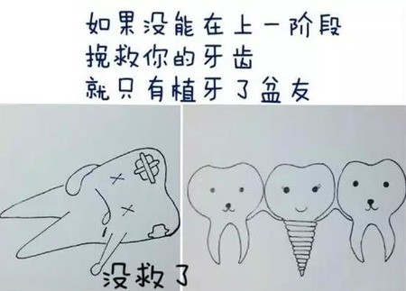 龋齿（蛀牙）的治疗方法，如果龋齿不治疗会怎么样？
