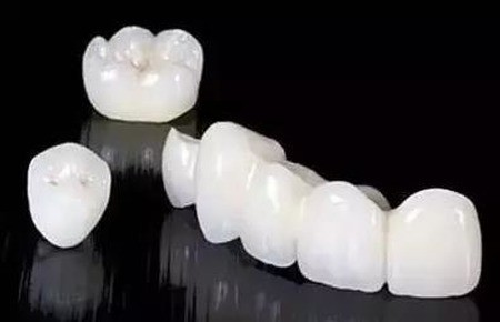 刚做完根管治疗要给牙齿带牙冠，牙冠材料都有什么区别？