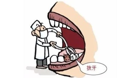 拔牙后不能坐飞机是真的还是假的