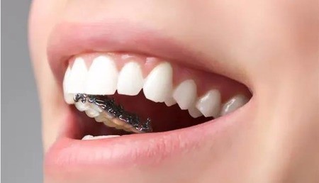 牙齿正畸拔牙好吗？