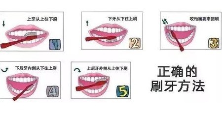 牙龈萎缩如何预防较为有效？