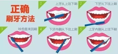 牙龈萎缩要怎么预防保健！