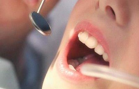 怎么防止蛀牙继续恶化？