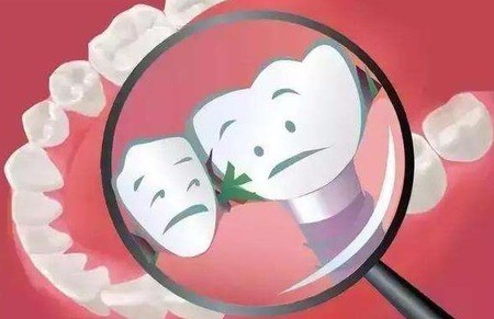 后槽牙塞牙怎么办？