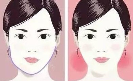 左脸比右脸大怎么回事？