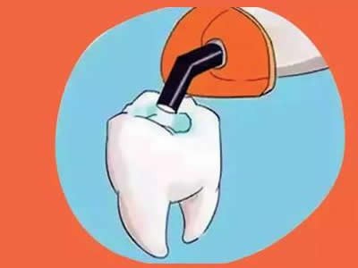 补牙后一般能维持几年？