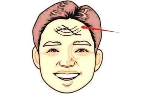 脸部凹陷怎么自己恢复?