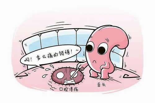 口腔溃疡反复发作怎么有效治疗?