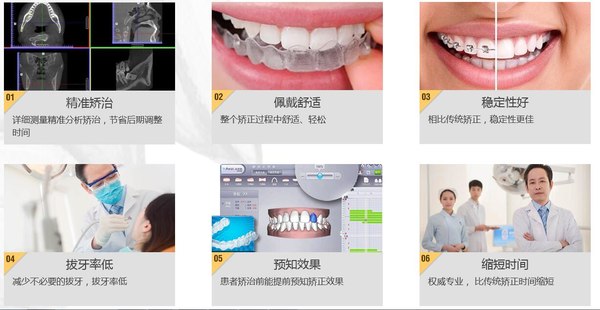 襄阳时代口腔诊所特色之一
