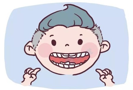双排牙恢复的方法有哪些？