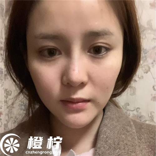 20190222102327262.jpg