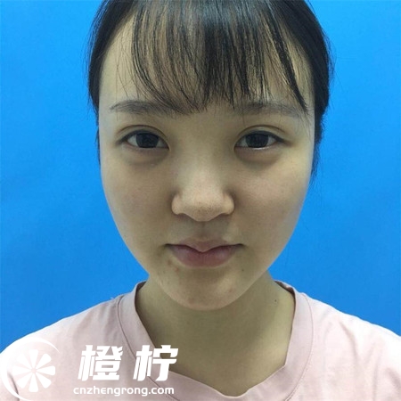 20190225022252852.jpg