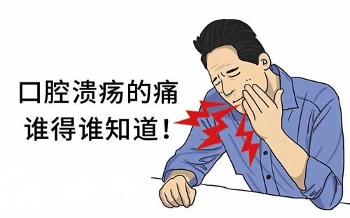 口腔溃疡