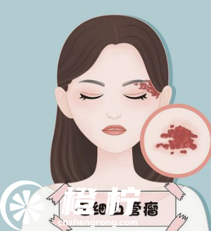 双眼皮动漫h84.jpg