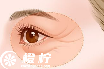 北京安贞医院整形美容科