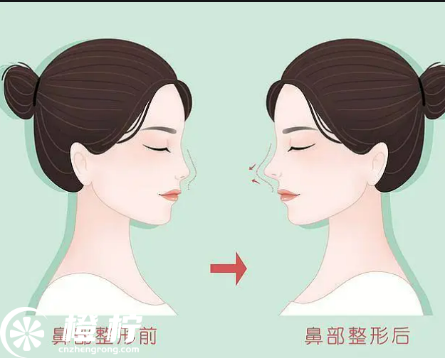 北京大学深圳医院整形外科