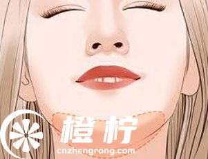 深圳米兰柏羽医疗美容整形门诊部