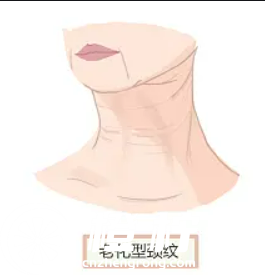 l祛痣q01.jpg