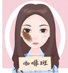 [榜单]丽水做双眼皮哪家医院好？医院排名|人民医院、芘丽芙口腔外科、华美医疗这几家医院口碑都不错哦！