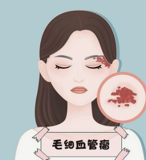 沭阳中医院祛疤手术做的好不好？来该医院做手术的务必要看完！