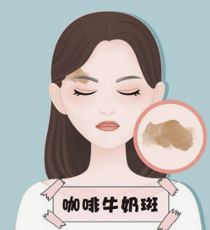 臀部吸脂让我找回了很美的那个自己