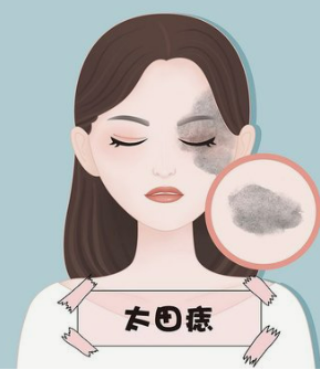 哪些因素会影响植发的成功呢男士(什么会影响植发的成活率)