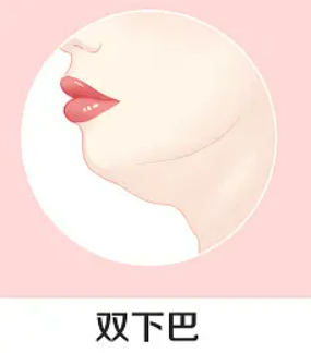 南京内切去眼袋价位表2023新版全网发布(2023南京内切去眼袋参考价为：28415元)