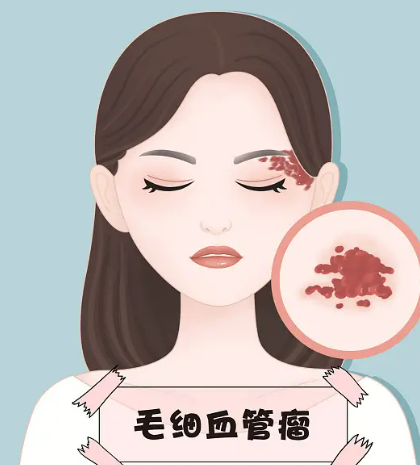 2023广州中面部除皱靠谱的口腔美容医院排行榜汇总公示！广州丽港丽格医院放心选择不踩雷