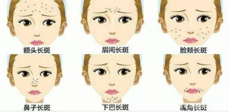 厦门天济医院祛痘如何？做祛痘手术你会来该医院吗？