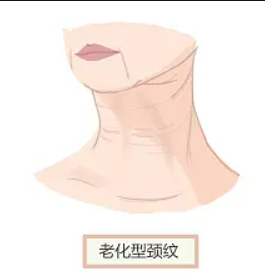 协和医院曾昂隆胸好吗？医生技术点评+真实案例:要的就是